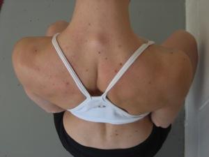 Scapular Retraction and Depression- side view