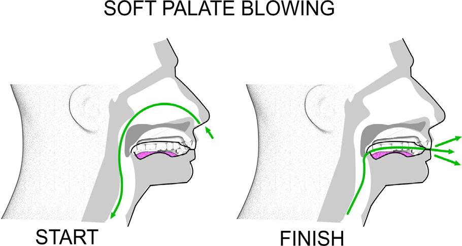 EXERCISES FOR THE SOFT PALATE BLOWING 1. Inhale air through your nose. 2. Exhale via your mouth. As you exhale press your lips together. This action forms a resistance. 3.