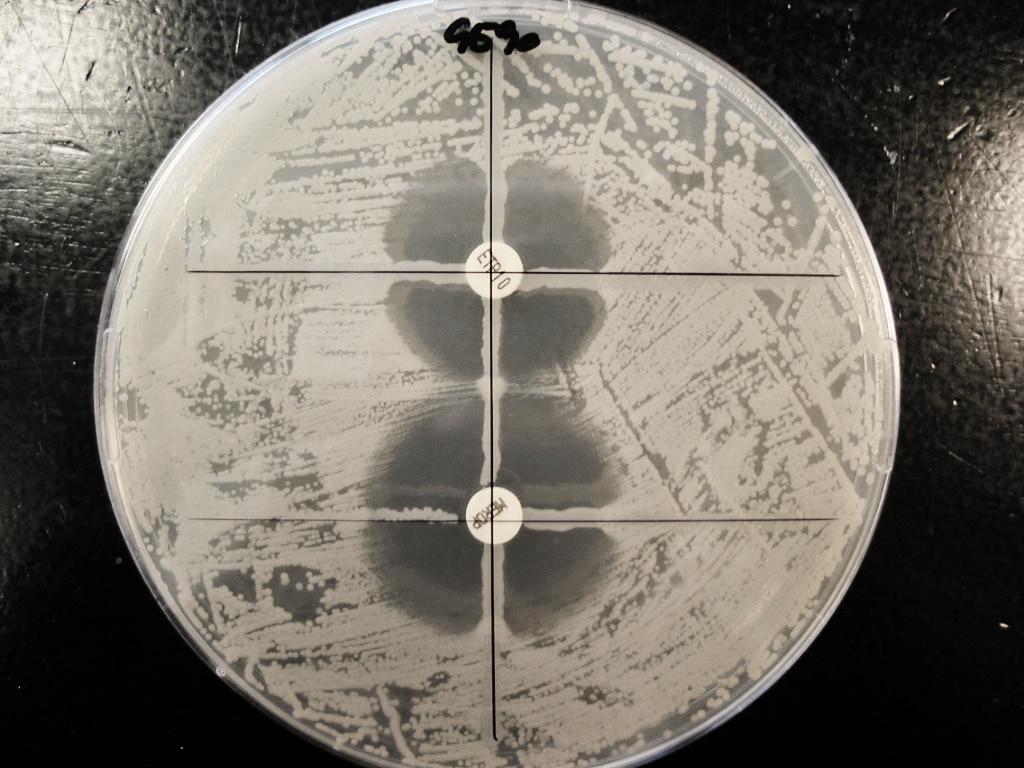MODIFIED HODGE TEST (MHT) Is used to determine if resistance to carbapenems is caused by a carbapenemase. A MH agar plate (or a McConkey plate) is inoculated with the susceptible strain E.