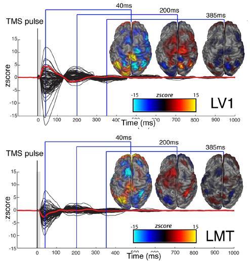 frontal and parietal EEG signature Convergence from nodes to hubs Hp Evoked potentials in large-scale
