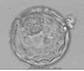 Chromosome status Expected outcome If testing had occurred Embryo 1 No abnormality Normal live birth Suitable for