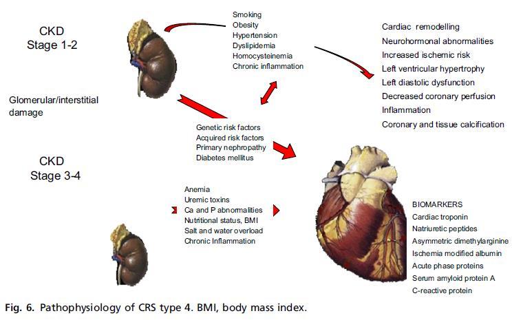 Cardio-Renal Syndrome Type 4 Ronco C,