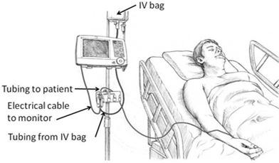A continuous fluid filled line from the IV bag to the transducer and from the transducer to the catheter tip is needed in order to monitor pressures.