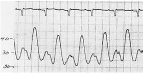 a c Identify two problems this patient has.