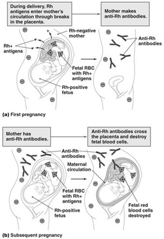Hemolytic Disease of Newborn 40 Prevention Passive immunity using anti-rh factor immunoglobulin 28-38 weeks Immediately after delivery Administer