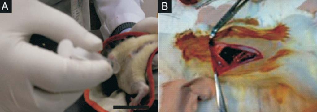 51 Figure 1. (A) Picture showing the intraperitoneal administration of chemotherapeutic agents. (B) Laparotomy in sterile conditions samples were preserved in 10% formaldehyde solution.