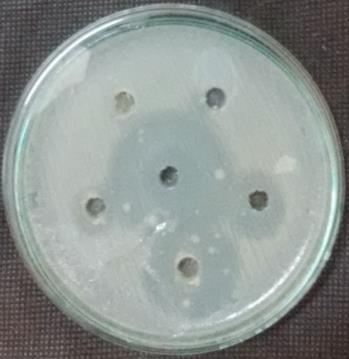 Antibacterial activity of Tabebuia rosea Pathogens 20µL 40µL 60µL 80µL