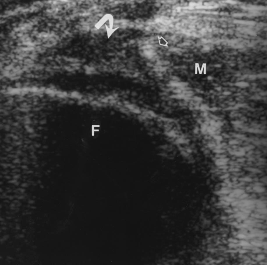 Ward et al. the ipsilateral knee.