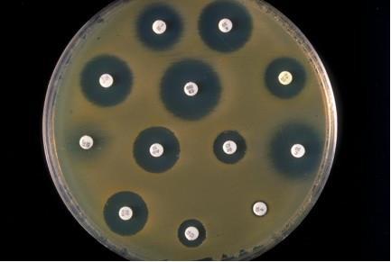 Decontamination Replicate cultures with different antibiotics Sputum collection minimum 2 weeks, up to 2 months DST