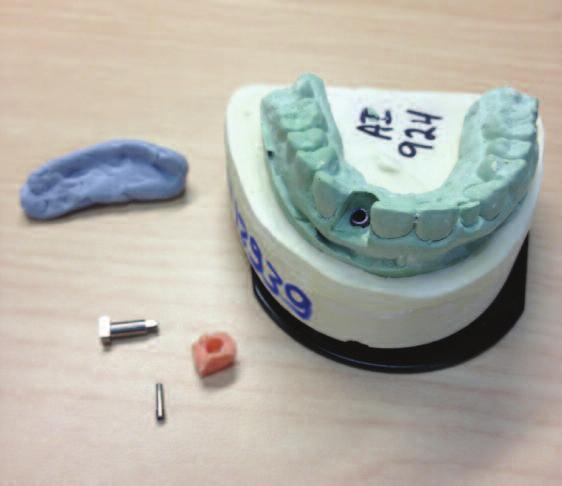 Instructions For Scanning A Stone Model With An Occlusal Registration (continued) 7.
