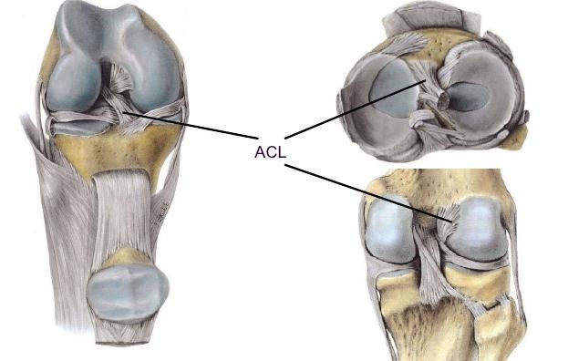 4- The cruciate ligaments: -The Anterior CL extends between the anterior part of the intercondylar area of the tibia & the lateral wall of the intercondylar