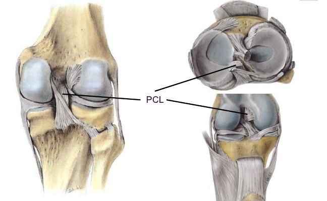 -The Posterior CL extends between the posterior aspect of the intercondylar area of the tibia & the medial wall of the