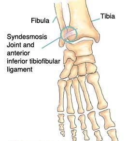 Tibiofibular joints: Distal TF joint: - Syndesmotic (fibrous) plane joint - Formed by the rough, convex surface of the medial side of the distal fibula with the rough concave surface on the lateral