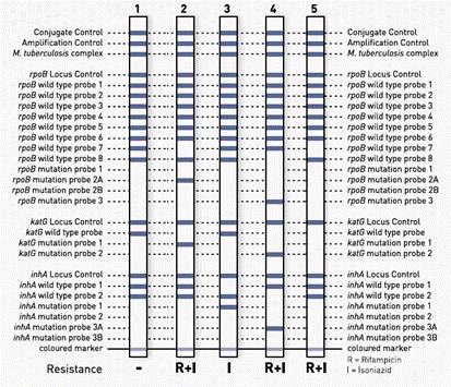 Figure 5 GenoType MTBDRplus VER 2.0 Sample Results https://www.hain-lifescience.de/en/products/microbiology/mycobacteria/tuberculosis/genotype-mtbdrplus.