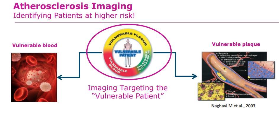 Atherosclerosis Imaging Early