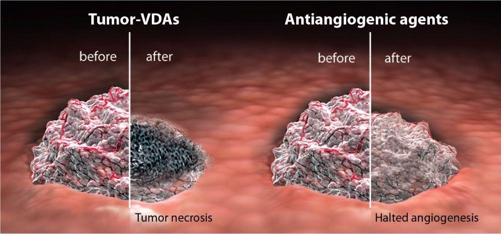 Tumor-VDAs vs Antiangiogenic Agents Disrupt established blood vessels Cause vessel occlusion and inhibition of blood flow Tumor necrosis, major effect on central part of tumor Interfere with new