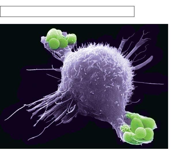 Innate defenses Internal defenses (a) A macrophage (purple) uses its cytoplasmic extensions