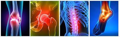 MUSCULOSKELETAL AGENTS There are many diseases and disorders of the musculoskeletal system.