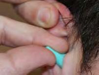 and outwards while inserting earplug with other hand.