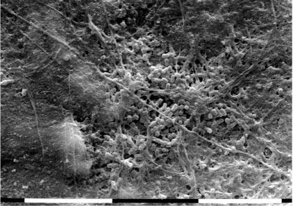 BACTERIAL COLONIZATION AND FIXED APPLIANCES 477 in graded alcohols, desiccated by critical point drying, mounted on aluminium stubs, and sputter coated with gold prior to SEM examination (Philips SEM