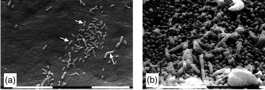 (b) Coarse filler particles projecting above the resin surface are clearly seen at higher magnification. Original magnification 4200 (bar = 10 µm).