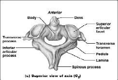 The Axis Has a body and spinous process Dens (odontoid process) projects superiorly Formed from fusion of the body of the atlas with the axis Acts as a pivot for rotation of the atlas and skull