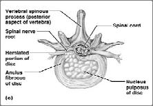 five major regions Cervical vertebrae 7 vertebrae of the neck region Thoracic vertebrae 12 vertebrae of the