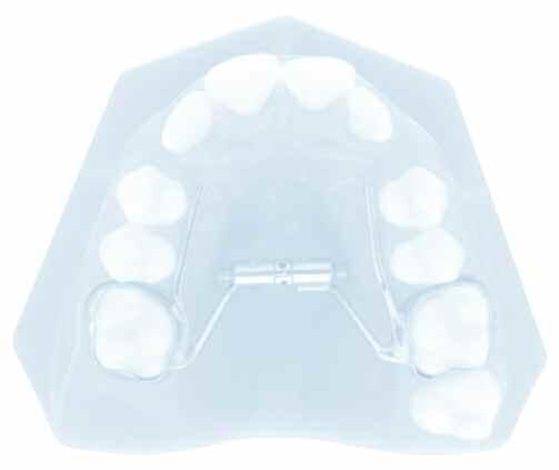 SECTION 11 PAGE 2 ALLESEE ORTHODONTIC APPLIANCES AOA Laboratory Your Trusted Source for a Complete Range of Customized Appliances Dear Doctor: For more than 35 years, AOA has set the standard in