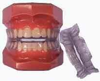 SECTION 11 PAGE 22 ALLESEE ORTHODONTIC APPLIANCES Splints AOA can process splints in many designs. Images of the most popular ones are listed here.