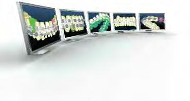 SECTION 2 PAGE 2 DIGITAL SYSTEMS Insignia Combining Artistic Design with Precision Engineering Insignia is an integrated system of 3-D digital orthodontics with customized appliances for a truly