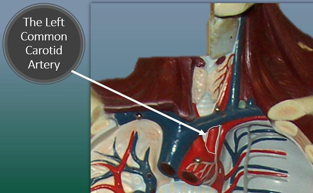 The descending aorta is the portion of the aorta that comes just after the aortic arch.