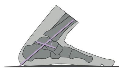 Ankles bend in two sagittal directions plantarflexion (from Latin plantaris flectere or sole bent ), and dorsiflexion (bent toward the dorsal or upper side of the foot).