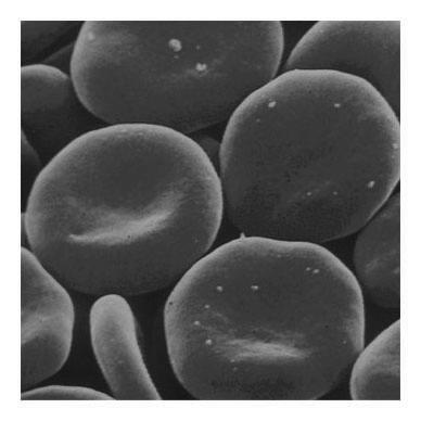 function Centrifuged blood sample Leukocytes (white blood cells) 5,000 10,000 Defense and immunity Plasma proteins Osmotic balance and ph buffering Basophil Lymphocyte Fibrinogen Immunoglobulins
