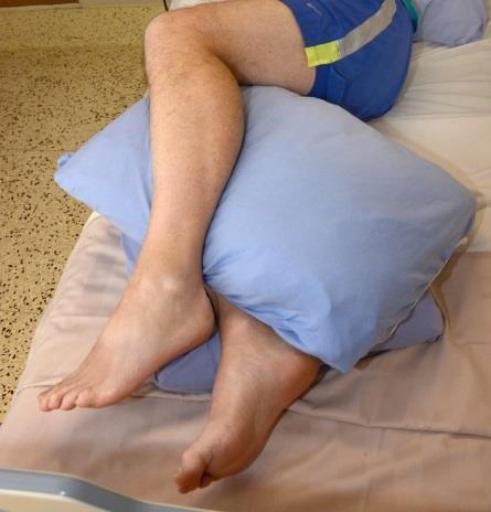 Here is another example of floating the feet off the bed using pillows. Waffle boots are an example of a device. Floating feet off bed. What are the risk factors?