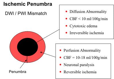B. CLASSIFICATION OF ISCHEMIC EVENTS (These are based on the temporal course and eventual outcome.) 1. Transient Ischemic Attacks (TIAs) a.