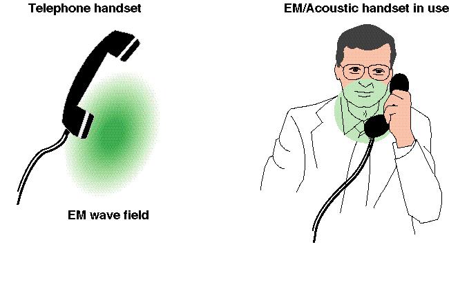 EM speech articulator sensors are easily