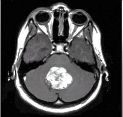 MRI of a