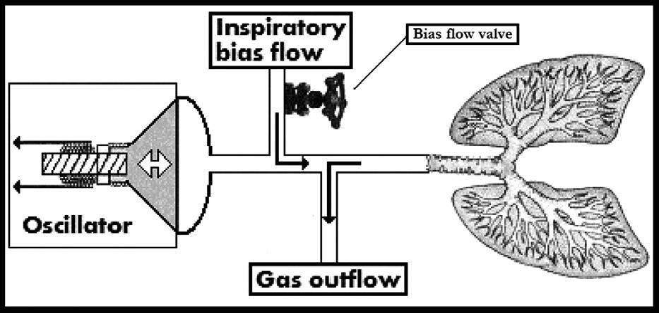 218 Journal of Intensive Care Medicine / Vol. 24, No. 4, July/August 2009 Figure 2. Basic design of the high frequency oscillating ventilator.