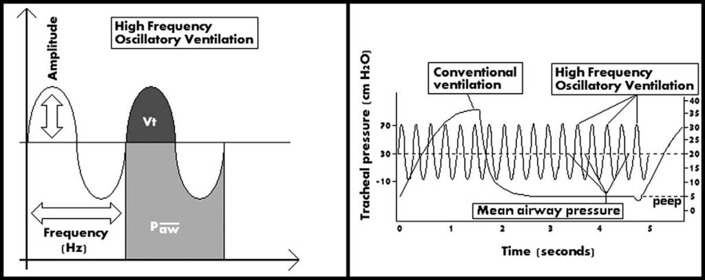 Waveforms depicting the key variables that are controlled during high frequency oscillation as compared to conventional ventilation.
