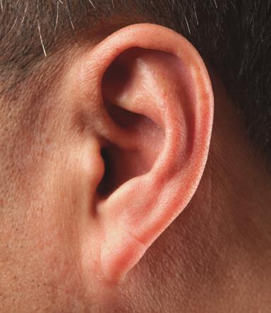IN-THE-EAR STYLES Invisible in the Canal (IIC) The smallest custom style, IIC instruments, sit invisibly in or past the second bend of the ear canal.
