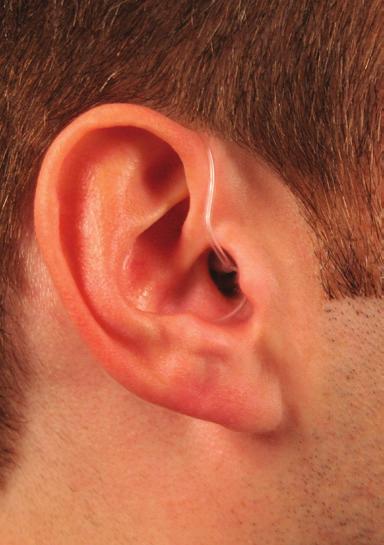 Behind-the-ear (BTE) hearing aids sit behind or on top of the outer ear, with tubing that routes the sound into the ear canal.