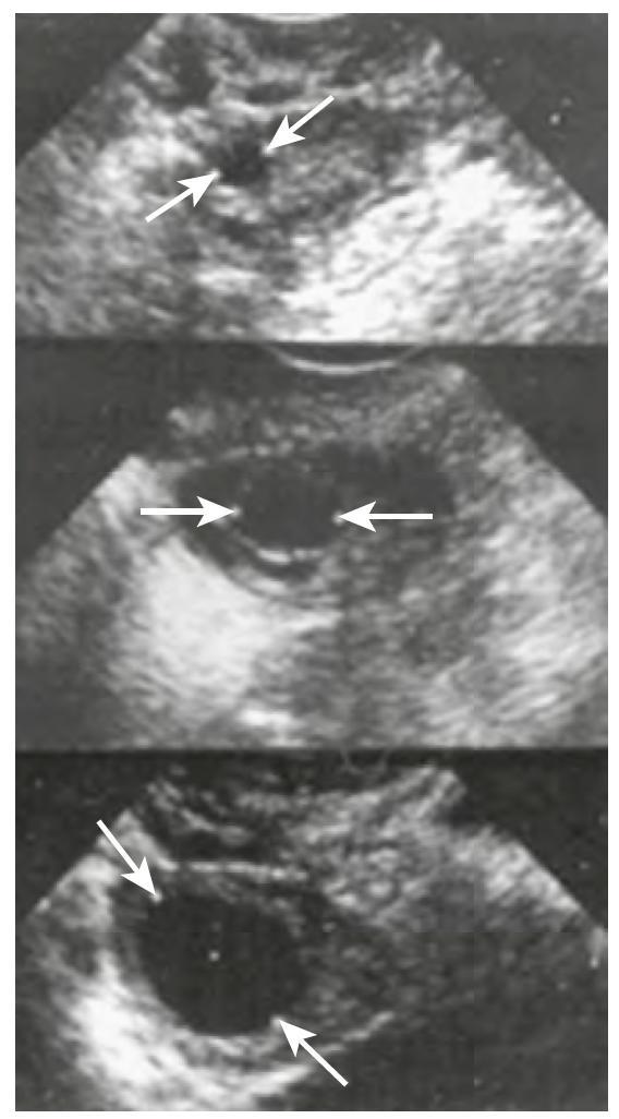 Ultrasound images of ovarian & uterine development Early