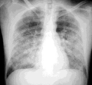 Heart Failure Case 3 Q1: Who should look after this patient in Hospital? A. Cardiologist B.