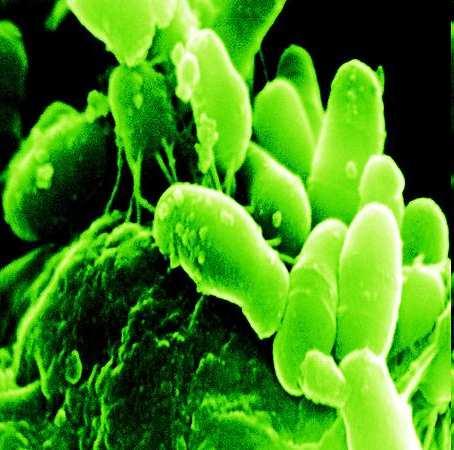 Intestinal Bacteria good?