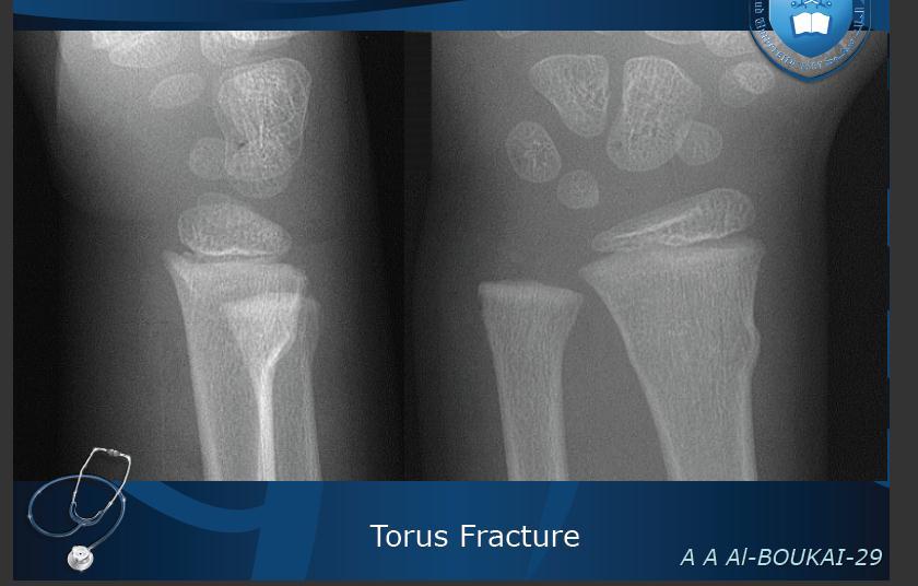 Lateral Frontal - Pediatric wrist joint because we can see the growth plate.
