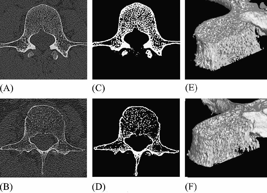 High-Resolution CT imaging Important information can be obtained from structure analysis of
