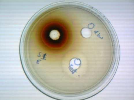 Figure 3: Antibiogram of