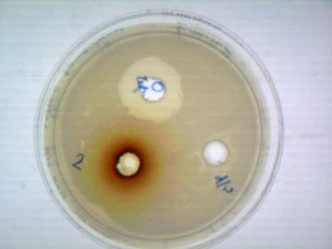 Rose   Figure 4: Antibiogram of
