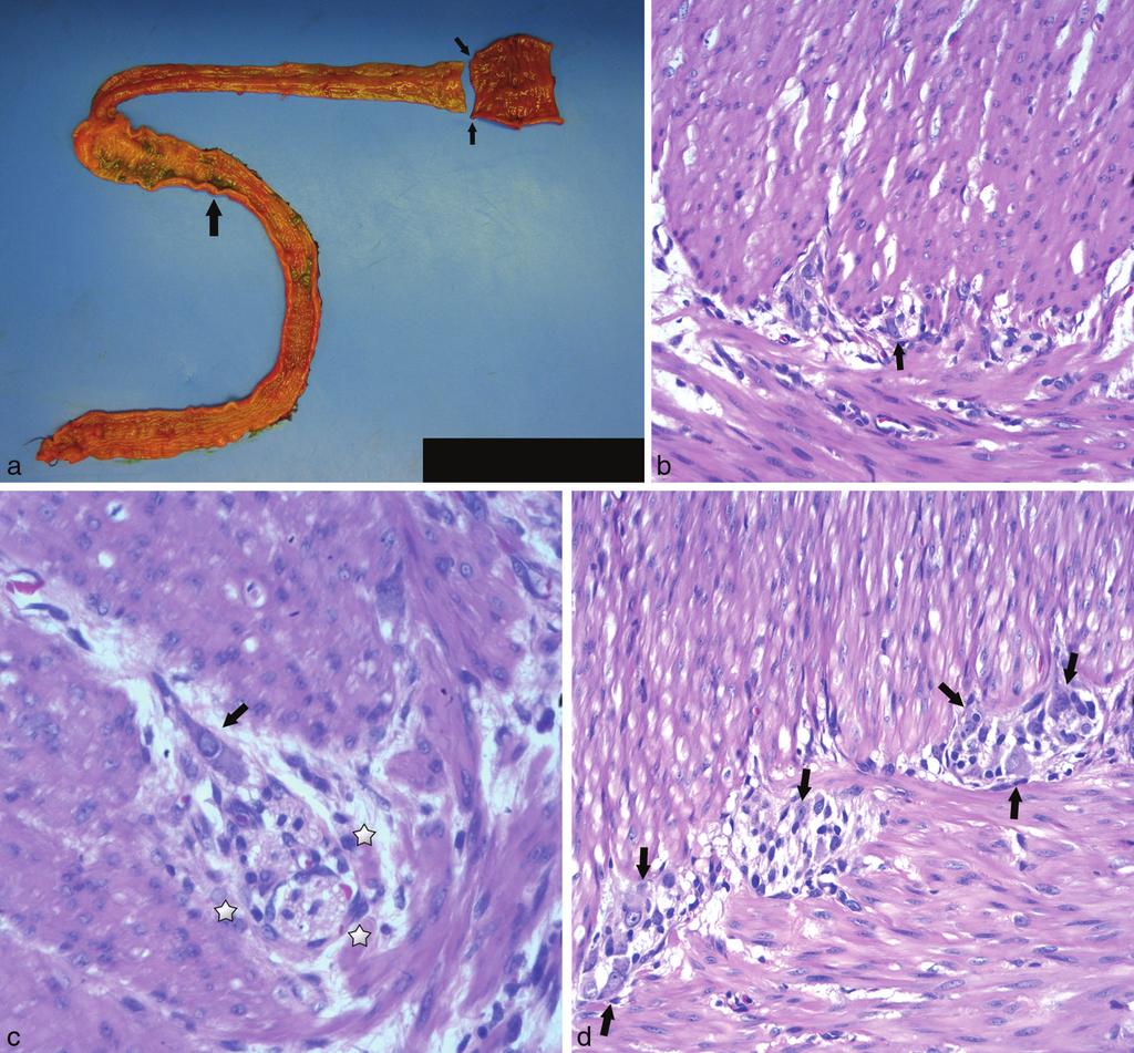 Figure 3. Segment of ileum and colon proximal to the splenic flexure. Additional shorter segment of ileum is received separately (a).