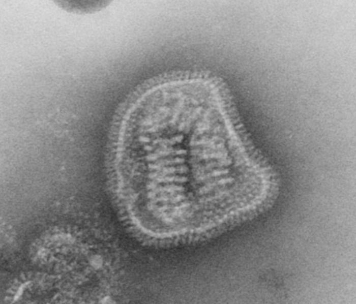Electron Micrograph of Viral